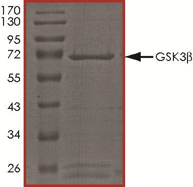 Recombinant Human Active GSK-3 beta Protein SDS-PAGE