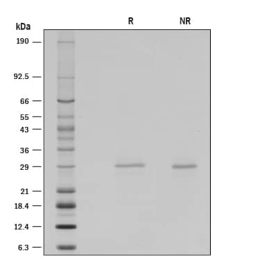 Recombinant Human Galectin-3 (Human Cell-expressed) SDS-PAGE