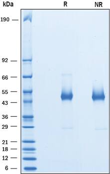 Recombinant Human HSP47 His-tag Protein SDS-PAGE