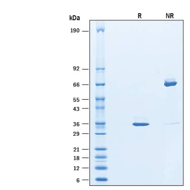 Recombinant Human Hepassocin/FGL1 His-tag Protein SDS-PAGE