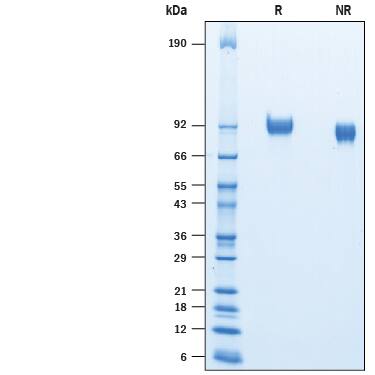 Recombinant Mouse ICAM-1/CD54 His-tag Protein SDS-PAGE
