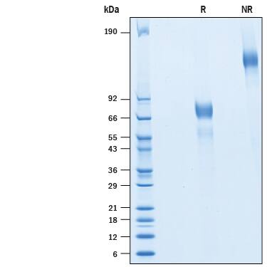Recombinant Human ICAM-4 Fc Chimera Protein SDS-PAGE