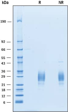 Recombinant Human ICOS (aa 21-134) His-tag Protein SDS-PAGE