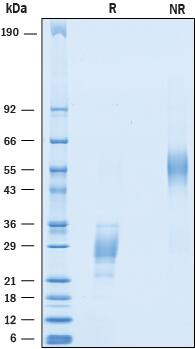 Recombinant Human ICOS (aa 21-140) His-tag Protein SDS-PAGE