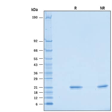 Recombinant Mouse IFN-alpha 2/IFNA2 Protein SDS-PAGE