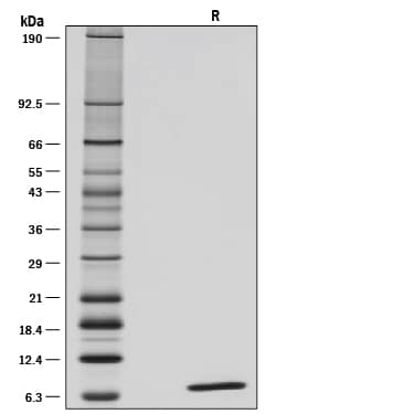 Recombinant Human IGF-I/IGF-1 GMP Protein SDS-PAGE