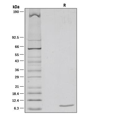 Recombinant Mouse IGF-I/IGF-1 Protein SDS-PAGE