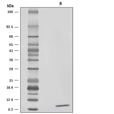 Recombinant Human LR3 IGF-I/IGF-1 Protein SDS-PAGE