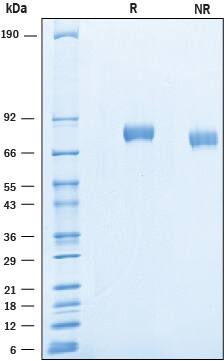 Recombinant Human IGFALS/ALS Protein SDS-PAGE