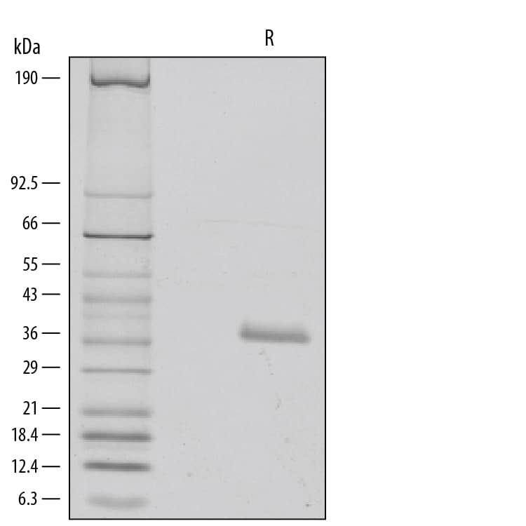 Recombinant Human IGFBP-rp1/IGFBP-7 (K95R) Protein SDS-PAGE