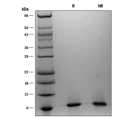 ProDots Recombinant Human IGF-I/IGF-1 Protein SDS-PAGE