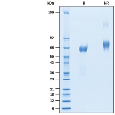 Recombinant Human IGSF21 His-tag Protein SDS-PAGE