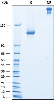 Recombinant Mouse IGSF2/CD101 Fc Chimera Protein SDS-PAGE