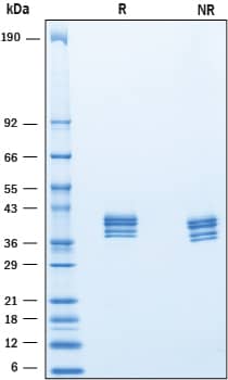 Recombinant Mouse IGSF4B/SynCAM3 His-tag Protein SDS-PAGE