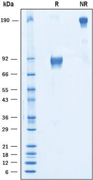 Recombinant Human IGSF4C/SynCAM4 Fc Chimera Protein SDS-PAGE