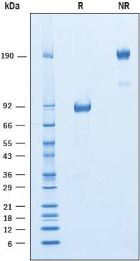Recombinant Mouse IGSF4C/SynCAM4 Fc Chimera Protein SDS-PAGE