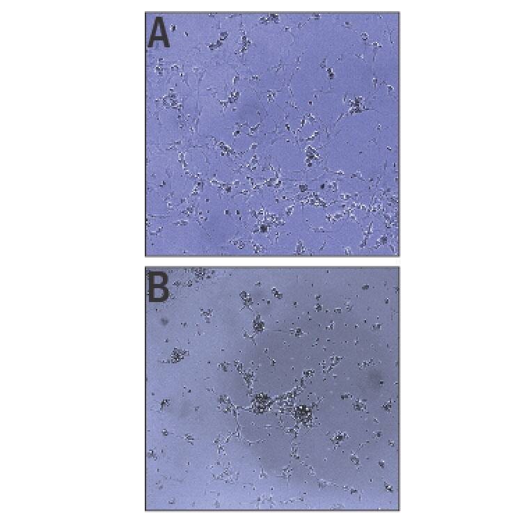 Recombinant Human IGSF9B Protein Bioactivity