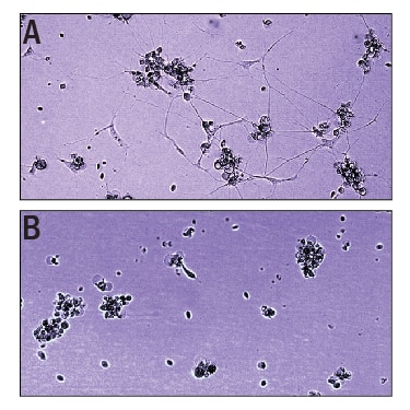 Recombinant Mouse IGSF9 Protein Bioactivity