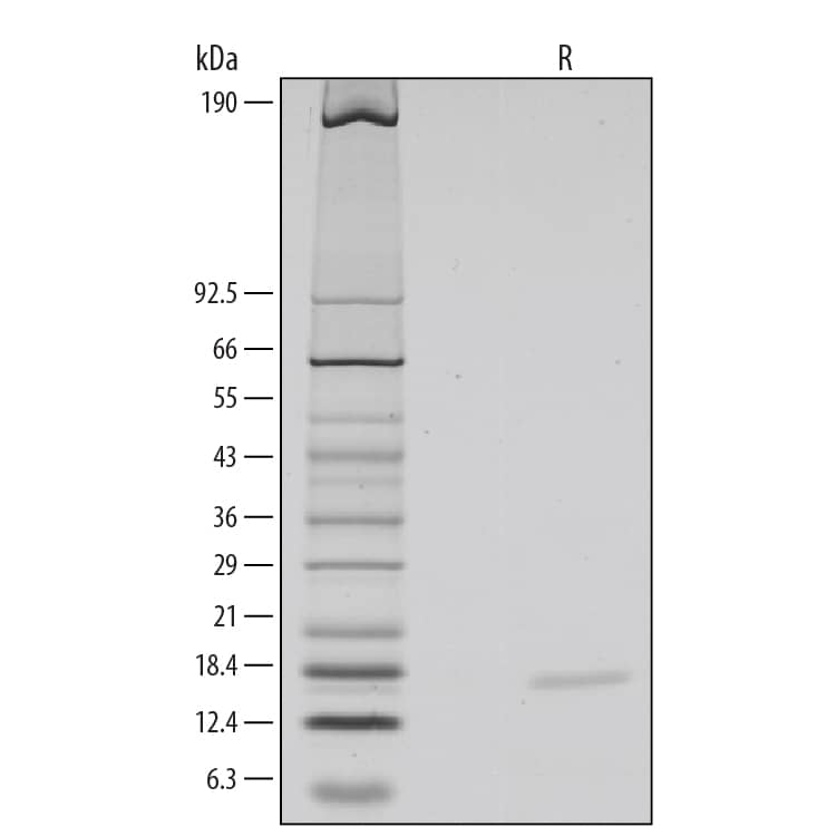 Recombinant Mouse IL-10 Protein SDS-PAGE