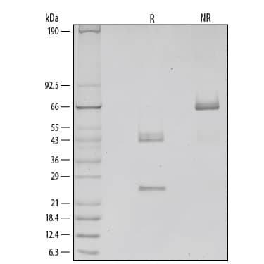 Recombinant Mouse IL-12 Protein SDS-PAGE
