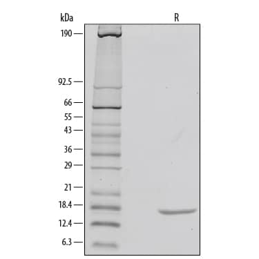 Recombinant Rat IL-1 beta/IL-1F2 Protein SDS-PAGE