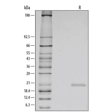 Recombinant Human IL-1ra/IL-1F3 Protein SDS-PAGE