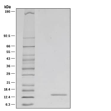 Recombinant Mouse IL-21 Protein SDS-PAGE