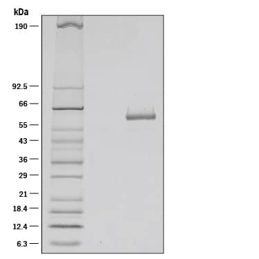 Recombinant Mouse IL-27 (NS0-expressed) Protein SDS-PAGE
