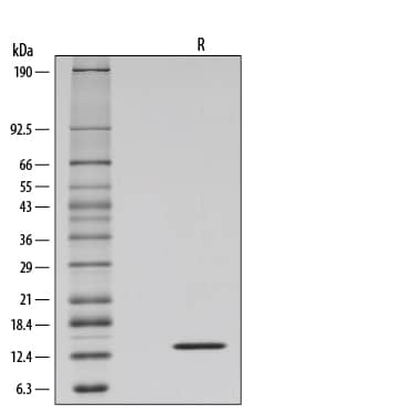 Recombinant Human IL-2 GMP Protein SDS-PAGE