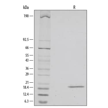 Recombinant Human IL-33 Protein SDS-PAGE