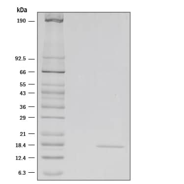 Recombinant Mouse IL-36 alpha/IL-1F6 (aa 8-160) Protein SDS-PAGE