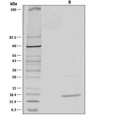 Recombinant Mouse IL-36 beta/IL-1F8 (aa 31-183) Protein SDS-PAGE