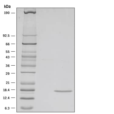 Recombinant Human IL-36 gamma/IL-1F9 (aa 18-169) Protein SDS-PAGE