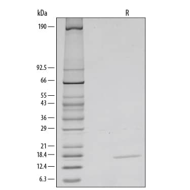 Recombinant Mouse IL-3 Protein SDS-PAGE Recombinant Mouse IL-3 Protein SDS-PAGE