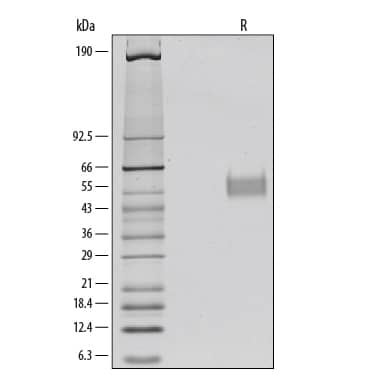 Recombinant Human IL-3R alpha/CD123 Protein SDS-PAGE