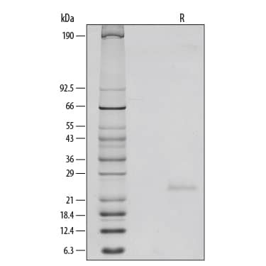Recombinant Mouse IL-6 Protein SDS-PAGE