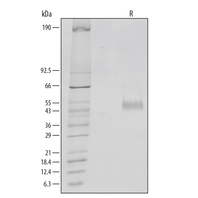 Recombinant Human IL-6R alpha Protein SDS-PAGE