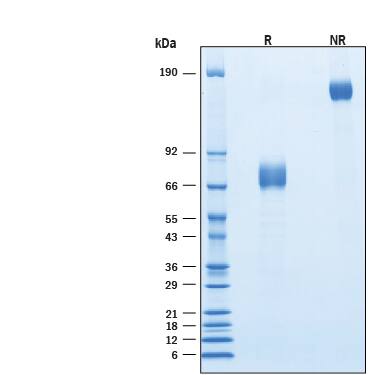 Recombinant Cynomolgus IL-10 R alpha Fc Chimera Protein SDS-PAGE