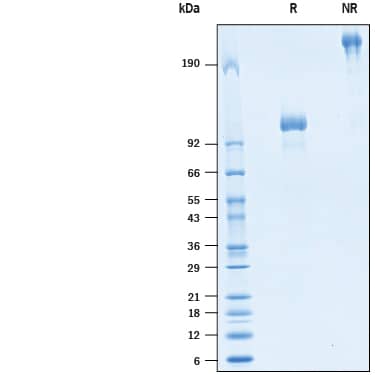 Recombinant Human IL-12 R beta 1 Fc Avi-tag Protein SDS-PAGE
