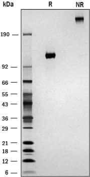 Recombinant Human IL-12 R beta 2 Fc Chimera Protein SDS-PAGE