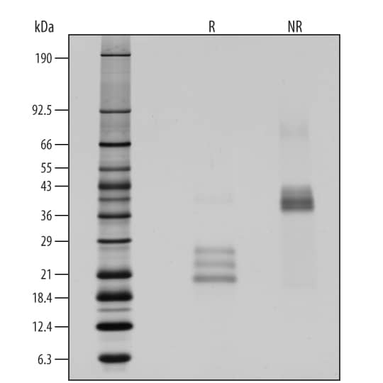 IL-17E Induces CXCL1/GRO alpha Secretion.