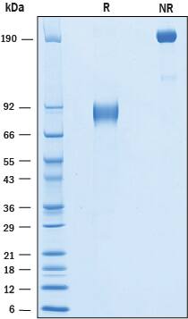 Recombinant Human IL1RAPL1 Protein SDS-PAGE