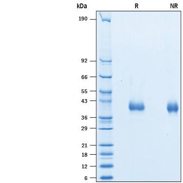 Recombinant Human IL-2 R beta His-tag Avi-tag Protein SDS-PAGE