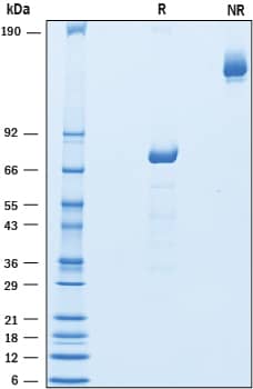 Recombinant Human IL-39 Fc Chimera Protein SDS-PAGE