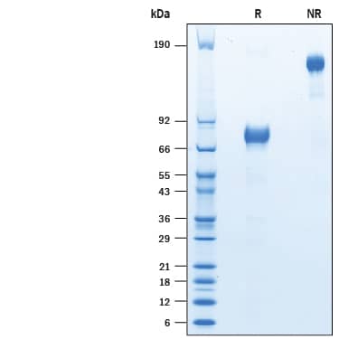 Recombinant Human IL-4R alpha Fc Chimera Avi-tag Protein SDS-PAGE