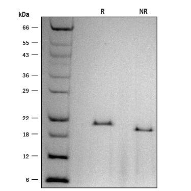 ProDots Recombinant Human IL-6 Protein SDS-PAGE