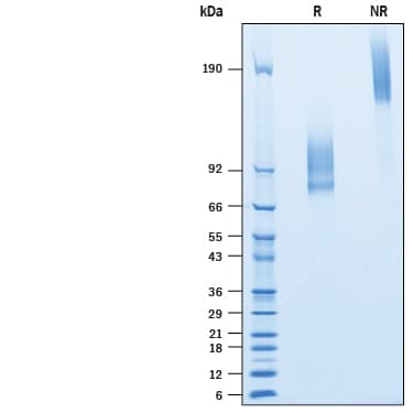 Recombinant Human IL-7R alpha/CD127 Fc Avi-tag Protein SDS-PAGE