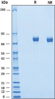Recombinant Mouse IL-Y Protein SDS-PAGE