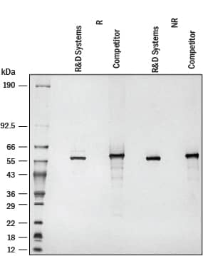Recombinant Human IMP Dehydrogenase 2/IMPDH2 Protein SDS-PAGE