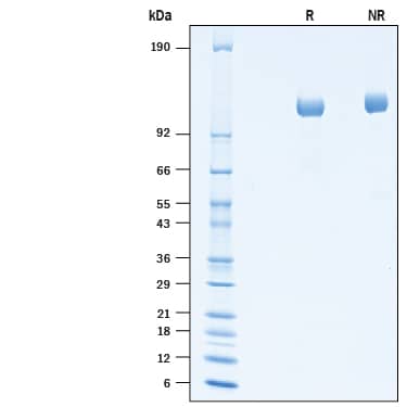 Recombinant Human ITIH4 His-tag Protein SDS-PAGE